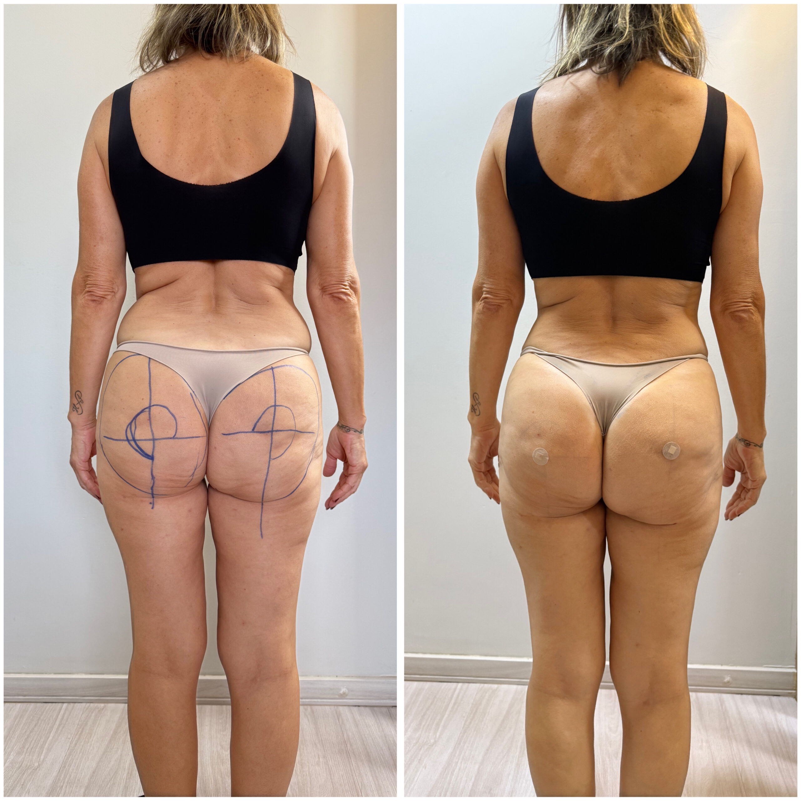 57212701-18E4-4751-B3E0-6CF065E954BA